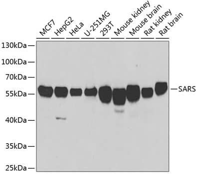 Western Blot: Seryl tRNA synthetase Antibody [NBP3-38321] - Western blot analysis of various lysates using Seryl tRNA synthetase Rabbit pAb at 1:1000 dilution.Secondary antibody: HRP-conjugated Goat anti-Rabbit IgG (H+L) at 1:10000 dilution.Lysates/proteins: 25ug per lane.Blocking buffer: 3% nonfat dry milk in TBST.Detection: ECL Basic Kit.Exposure time: 90s.