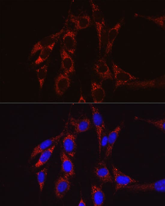 Immunocytochemistry/ Immunofluorescence SECISBP2 Antibody