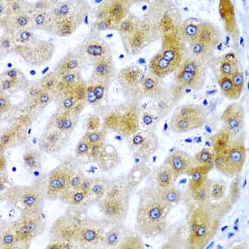 Immunohistochemistry SECISBP2 Antibody