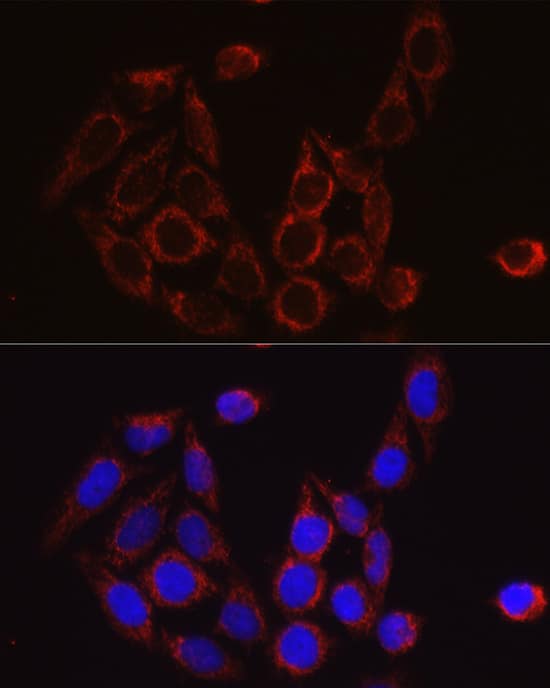 Immunocytochemistry/ Immunofluorescence SECISBP2 Antibody