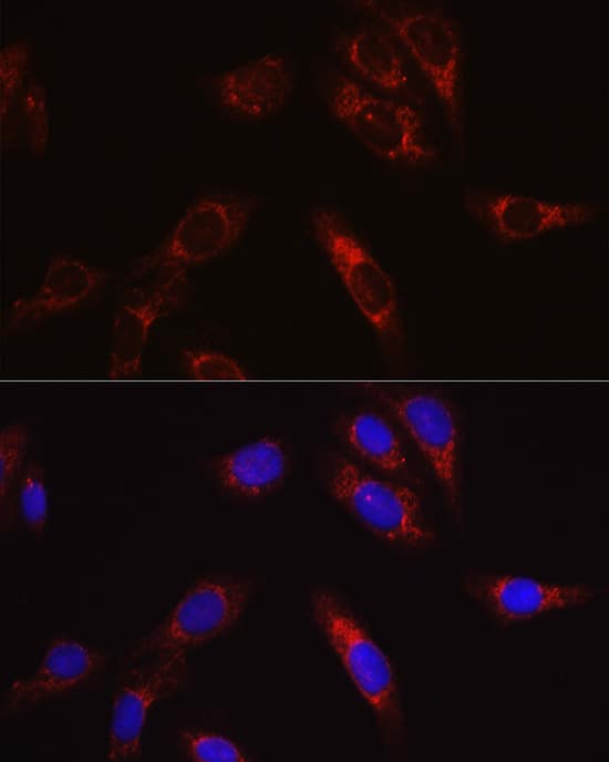 Immunocytochemistry/ Immunofluorescence: SECISBP2 Antibody [NBP3-38323] - Immunofluorescence analysis of U2OS cells using SECISBP2 Rabbit pAb at dilution of 1:50 (40x lens). Secondary antibody: Cy3-conjugated Goat anti-Rabbit IgG (H+L) at 1:500 dilution. Blue: DAPI for nuclear staining.