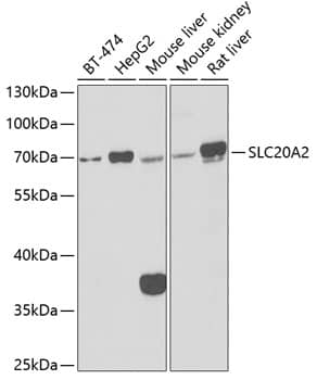 Western Blot: SLC20A2 Antibody [NBP3-38324] - Western blot analysis of various lysates using SLC20A2 Rabbit pAb at 1:1000 dilution.Secondary antibody: HRP-conjugated Goat anti-Rabbit IgG (H+L) at 1:10000 dilution.Lysates/proteins: 25ug per lane.Blocking buffer: 3% nonfat dry milk in TBST.Detection: ECL Basic Kit.Exposure time: 90s.