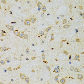 Immunohistochemistry: SRP19 Antibody [NBP3-38326] - Immunohistochemistry analysis of paraffin-embedded Rat brain using SRP19 Rabbit pAb at dilution of 1:100 (40x lens). Microwave antigen retrieval performed with 0.01M PBS Buffer (pH 7.2) prior to IHC staining.