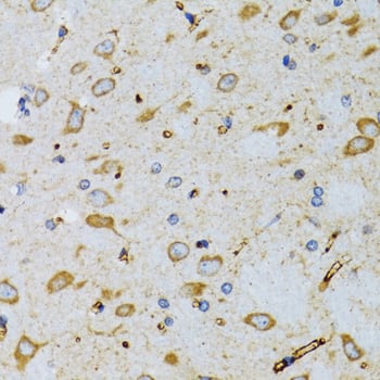 Immunohistochemistry SRP19 Antibody