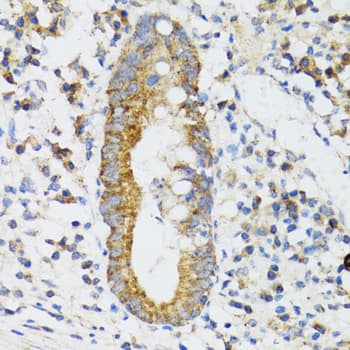 Immunohistochemistry SRP19 Antibody