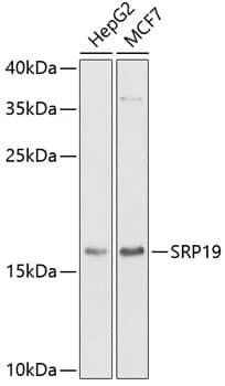 Western Blot SRP19 Antibody