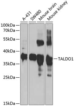 Western Blot: Transaldolase 1 Antibody [NBP3-38328] - Western blot analysis of various lysates using Transaldolase 1 Rabbit pAb at 1:1000 dilution.Secondary antibody: HRP-conjugated Goat anti-Rabbit IgG (H+L) at 1:10000 dilution.Lysates/proteins: 25ug per lane.Blocking buffer: 3% nonfat dry milk in TBST.Detection: ECL Basic Kit.Exposure time: 30s.