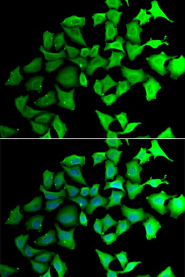 Immunocytochemistry/ Immunofluorescence: Transaldolase 1 Antibody [NBP3-38328] - Immunofluorescence analysis of HeLa cells using Transaldolase 1 Rabbit pAb. Secondary antibody: Cy3-conjugated Goat anti-Rabbit IgG (H+L) at 1:500 dilution. Blue: DAPI for nuclear staining.