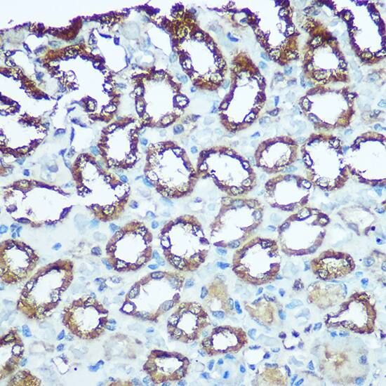 Immunohistochemistry: UQCRFS1 Antibody [NBP3-38332] - Immunohistochemistry analysis of paraffin-embedded Rat kidney using UQCRFS1 Rabbit pAb at dilution of 1:100 (40x lens). Microwave antigen retrieval performed with 0.01M Tris/EDTA Buffer (pH 9.0) prior to IHC staining.