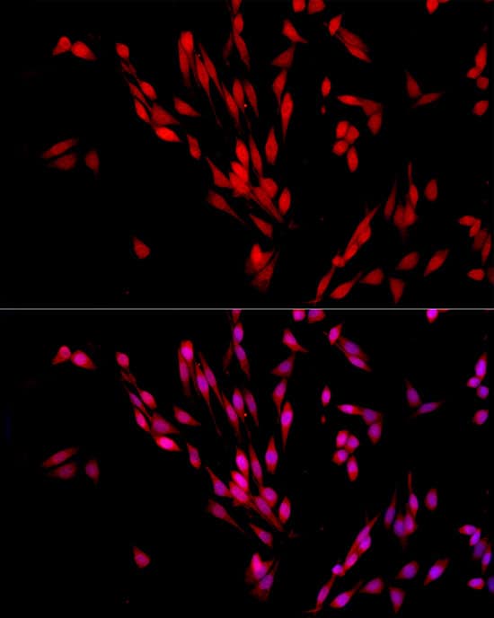 Immunocytochemistry/ Immunofluorescence: Exportin-5 Antibody [NBP3-38333] - Immunofluorescence analysis of PC-12 cells using Exportin-5(XPO5) Rabbit pAb at dilution of 1:500 (40x lens). Secondary antibody: Cy3-conjugated Goat anti-Rabbit IgG (H+L) at 1:500 dilution. Blue: DAPI for nuclear staining.