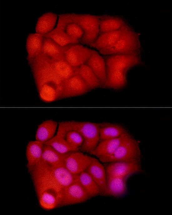 Immunocytochemistry/ Immunofluorescence: Exportin-5 Antibody [NBP3-38333] - Immunofluorescence analysis of MCF7 cells using Exportin-5(XPO5) Rabbit pAb at dilution of 1:500 (40x lens). Secondary antibody: Cy3-conjugated Goat anti-Rabbit IgG (H+L) at 1:500 dilution. Blue: DAPI for nuclear staining.