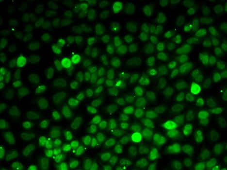 Immunocytochemistry/ Immunofluorescence: Exportin-5 Antibody [NBP3-38333] - Immunofluorescence analysis of MCF7 cells using Exportin-5(XPO5) Rabbit pAb.Secondary antibody: Cy3-conjugated Goat anti-Rabbit IgG (H+L) at 1:500 dilution.