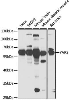 Western Blot: YARS Antibody [NBP3-38334] - Western blot analysis of various lysates using YARS Rabbit pAb at 1:1000 dilution.Secondary antibody: HRP-conjugated Goat anti-Rabbit IgG (H+L) at 1:10000 dilution.Lysates/proteins: 25ug per lane.Blocking buffer: 3% nonfat dry milk in TBST.Detection: ECL Basic Kit.Exposure time: 30s.