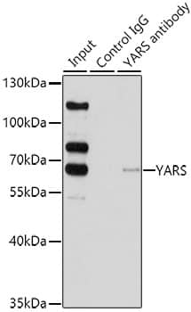 Immunoprecipitation: YARS Antibody [NBP3-38334] - Immunoprecipitation analysis of 200 ug extracts of HeLa cells using YARS antibody. Western blot was performed from the immunoprecipitate using YARS antibody at a dilution of 1:1000.