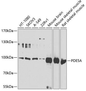 Western Blot: PDE5A Antibody [NBP3-38340] - Western blot analysis of various lysates using PDE5A Rabbit pAb at 1:1000 dilution.Secondary antibody: HRP-conjugated Goat anti-Rabbit IgG (H+L) at 1:10000 dilution.Lysates/proteins: 25ug per lane.Blocking buffer: 3% nonfat dry milk in TBST.Detection: ECL Basic Kit.Exposure time: 60s.