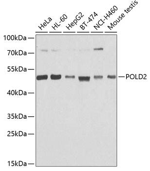 Western Blot: DNA polymerase delta p50 Antibody [NBP3-38341] - Western blot analysis of various lysates using DNA polymerase delta p50 Rabbit pAb at 1:1000 dilution.Secondary antibody: HRP-conjugated Goat anti-Rabbit IgG (H+L) at 1:10000 dilution.Lysates/proteins: 25ug per lane.Blocking buffer: 3% nonfat dry milk in TBST.Detection: ECL Basic Kit.Exposure time: 90s.