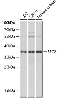 Western Blot: RFC2 Antibody [NBP3-38342] - Western blot analysis of various lysates using RFC2 Rabbit pAb at 1:1000 dilution.Secondary antibody: HRP-conjugated Goat anti-Rabbit IgG (H+L) at 1:10000 dilution.Lysates/proteins: 25ug per lane.Blocking buffer: 3% nonfat dry milk in TBST.Detection: ECL Basic Kit.Exposure time: 5s.