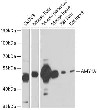 Western Blot: Salivary Amylase Alpha Antibody [NBP3-38344] - Western blot analysis of various lysates using Salivary Amylase Alpha Rabbit pAb at 1:1000 dilution.Secondary antibody: HRP-conjugated Goat anti-Rabbit IgG (H+L) at 1:10000 dilution.Lysates/proteins: 25ug per lane.Blocking buffer: 3% nonfat dry milk in TBST.Detection: ECL Enhanced Kit.Exposure time: 30s.