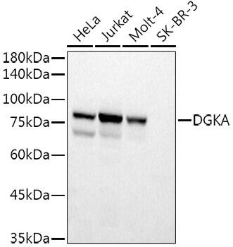 Western Blot: DGK-alpha Antibody [NBP3-38348] - Western blot analysis of various lysates using DGK-alpha Rabbit pAb at 1:500 dilution.Secondary antibody: HRP-conjugated Goat anti-Rabbit IgG (H+L) at 1:10000 dilution.Lysates/proteins: 25ug per lane.Blocking buffer: 3% nonfat dry milk in TBST.Detection: ECL Basic Kit.Exposure time: 3s.