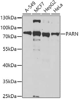 Western Blot: PARN Antibody [NBP3-38353] - Western blot analysis of various lysates using PARN Rabbit pAb at 1:1000 dilution.Secondary antibody: HRP-conjugated Goat anti-Rabbit IgG (H+L) at 1:10000 dilution.Lysates/proteins: 25ug per lane.Blocking buffer: 3% nonfat dry milk in TBST.Detection: ECL Basic Kit.Exposure time: 150s.