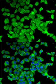 Immunocytochemistry/ Immunofluorescence: PARN Antibody [NBP3-38353] - Immunofluorescence analysis of MCF7 cells using PARN Rabbit pAb. Secondary antibody: Cy3-conjugated Goat anti-Rabbit IgG (H+L) at 1:500 dilution. Blue: DAPI for nuclear staining.