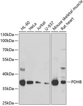 Western Blot: Pyruvate Dehydrogenase E1 beta subunit Antibody [NBP3-38354] - Western blot analysis of various lysates using Pyruvate Dehydrogenase E1 beta subunit Rabbit pAb at 1:1000 dilution.Secondary antibody: HRP-conjugated Goat anti-Rabbit IgG (H+L) at 1:10000 dilution.Lysates/proteins: 25ug per lane.Blocking buffer: 3% nonfat dry milk in TBST.Detection: ECL Basic Kit.Exposure time: 10s.