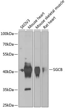 Western Blot: beta Sarcoglycan Antibody [NBP3-38356] - Western blot analysis of various lysates using beta Sarcoglycan Rabbit pAb at 1:1000 dilution.Secondary antibody: HRP-conjugated Goat anti-Rabbit IgG (H+L) at 1:10000 dilution.Lysates/proteins: 25ug per lane.Blocking buffer: 3% nonfat dry milk in TBST.Detection: ECL Basic Kit.Exposure time: 90s.