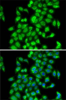 Immunocytochemistry/ Immunofluorescence: COP9 Antibody [NBP3-38362] - Immunofluorescence analysis of MCF7 cells using COP9 Rabbit pAb. Secondary antibody: Cy3-conjugated Goat anti-Rabbit IgG (H+L) at 1:500 dilution. Blue: DAPI for nuclear staining.