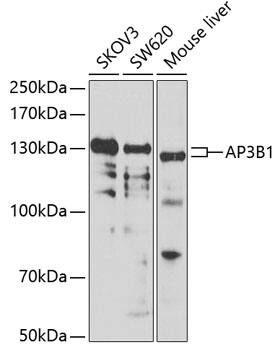 Western Blot: AP3B1 Antibody [NBP3-38363] - Western blot analysis of various lysates using AP3B1 Rabbit pAb at 1:1000 dilution.&lt;br/&gt;Secondary antibody: HRP-conjugated Goat anti-Rabbit IgG (H+L) at 1:10000 dilution.&lt;br/&gt;Lysates/proteins: 25ug per lane.&lt;br/&gt;Blocking buffer: 3% nonfat dry milk in TBST.&lt;br/&gt;Detection: ECL Basic Kit.&lt;br/&gt;Exposure time: 90s.