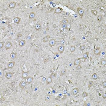 Immunohistochemistry: EIF3C Antibody [NBP3-38365] - Immunohistochemistry analysis of paraffin-embedded Mouse brain using EIF3C Rabbit pAb at dilution of 1:100 (40x lens). Microwave antigen retrieval performed with 0.01M PBS Buffer (pH 7.2) prior to IHC staining.