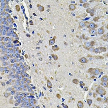 Immunohistochemistry: EIF3C Antibody [NBP3-38365] - Immunohistochemistry analysis of paraffin-embedded Rat brain using EIF3C Rabbit pAb at dilution of 1:100 (40x lens). Microwave antigen retrieval performed with 0.01M PBS Buffer (pH 7.2) prior to IHC staining.