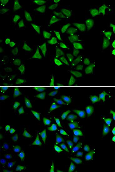 Immunocytochemistry/ Immunofluorescence: EIF3C Antibody [NBP3-38365] - Immunofluorescence analysis of U2OS cells using EIF3C Rabbit pAb. Secondary antibody: Cy3-conjugated Goat anti-Rabbit IgG (H+L) at 1:500 dilution. Blue: DAPI for nuclear staining.