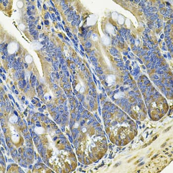 Immunohistochemistry: EIF3C Antibody [NBP3-38365] - Immunohistochemistry analysis of paraffin-embedded Mouse intestine using EIF3C Rabbit pAb at dilution of 1:100 (40x lens). Microwave antigen retrieval performed with 0.01M PBS Buffer (pH 7.2) prior to IHC staining.