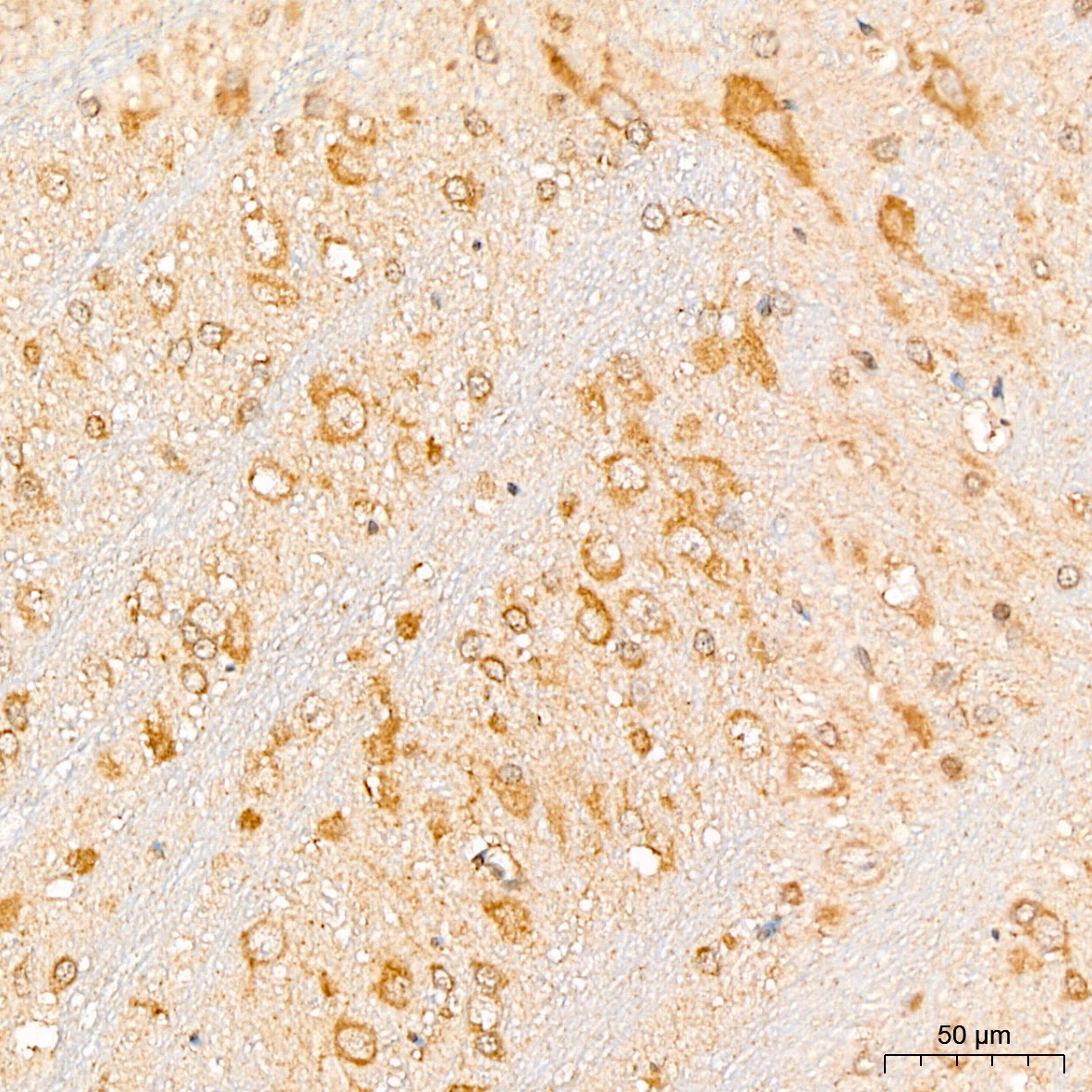 N/A EIF3F Antibody