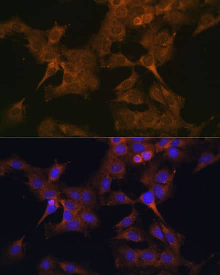 Immunocytochemistry/ Immunofluorescence EIF2B2 Antibody