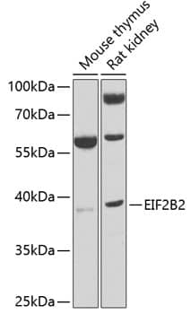 Western Blot: EIF2B2 Antibody [NBP3-38367] - Western blot analysis of various lysates using EIF2B2 Rabbit pAb at 1:1000 dilution.Secondary antibody: HRP-conjugated Goat anti-Rabbit IgG (H+L) at 1:10000 dilution.Lysates/proteins: 25ug per lane.Blocking buffer: 3% nonfat dry milk in TBST.Detection: ECL Basic Kit.Exposure time: 10s.