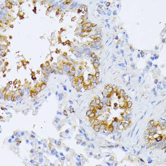 Immunohistochemistry EIF2B2 Antibody