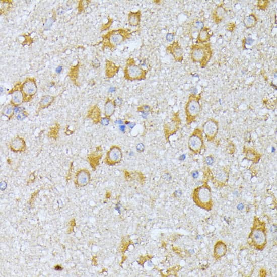 Immunohistochemistry EIF2B2 Antibody