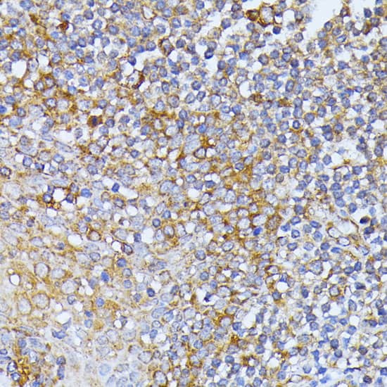 Immunohistochemistry: EIF2B2 Antibody [NBP3-38367] - Immunohistochemistry analysis of paraffin-embedded Human tonsil using EIF2B2 Rabbit pAb at dilution of 1:100 (40x lens). Microwave antigen retrieval performed with 0.01M PBS Buffer (pH 7.2) prior to IHC staining.