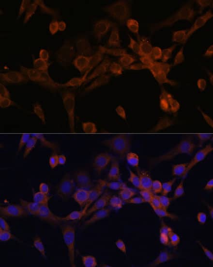 Immunocytochemistry/ Immunofluorescence: EIF2B2 Antibody [NBP3-38367] - Immunofluorescence analysis of NIH/3T3 cells using EIF2B2 Rabbit pAb at dilution of 1:100. Secondary antibody: Cy3-conjugated Goat anti-Rabbit IgG (H+L) at 1:500 dilution. Blue: DAPI for nuclear staining.