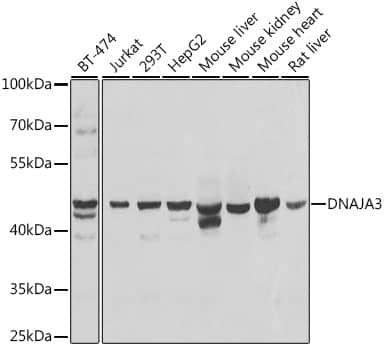 Western Blot: TID1 Antibody [NBP3-38368] - Western blot analysis of various lysates using TID1 Rabbit pAb at 1:1000 dilution.Secondary antibody: HRP-conjugated Goat anti-Rabbit IgG (H+L) at 1:10000 dilution.Lysates/proteins: 25ug per lane.Blocking buffer: 3% nonfat dry milk in TBST.Detection: ECL Basic Kit.Exposure time: 10s.