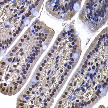 Immunohistochemistry: DNAJB6 Antibody [NBP3-38371] - Immunohistochemistry analysis of paraffin-embedded Mouse ileum using DNAJB6 Rabbit pAb at dilution of 1:100 (40x lens). Microwave antigen retrieval performed with 0.01M PBS Buffer (pH 7.2) prior to IHC staining.