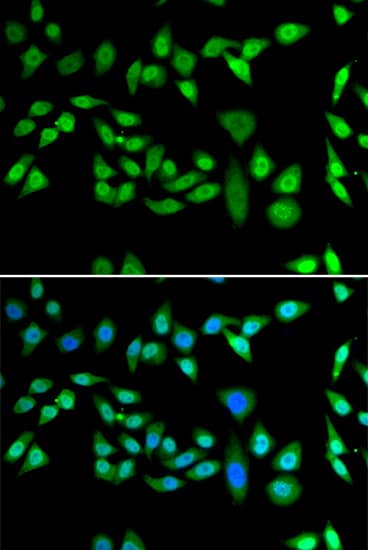 Immunocytochemistry/ Immunofluorescence: DNAJB6 Antibody [NBP3-38371] - Immunofluorescence analysis of U2OS cells using DNAJB6 Rabbit pAb. Secondary antibody: Cy3-conjugated Goat anti-Rabbit IgG (H+L) at 1:500 dilution. Blue: DAPI for nuclear staining.