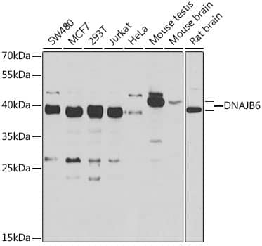 Western Blot: DNAJB6 Antibody [NBP3-38371] - Western blot analysis of various lysates using DNAJB6 Rabbit pAb at 1:1000 dilution. Secondary antibody: HRP-conjugated Goat anti-Rabbit IgG (H+L) at 1:10000 dilution. Lysates / proteins: 25 ug per lane. Blocking buffer: 3 % nonfat dry milk in TBST. Detection: ECL Basic Kit. Exposure time: 10s.