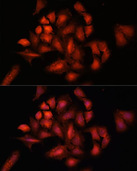 Immunocytochemistry/ Immunofluorescence: STAM2 Antibody [NBP3-38372] - Immunofluorescence analysis of U-2 OS cells using STAM2 Rabbit pAb at dilution of 1:100. Secondary antibody: Cy3-conjugated Goat anti-Rabbit IgG (H+L) at 1:500 dilution. Blue: DAPI for nuclear staining.