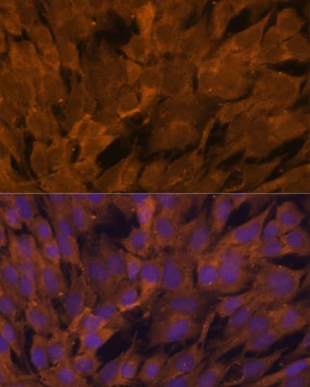 Immunocytochemistry/ Immunofluorescence: STAM2 Antibody [NBP3-38372] - Immunofluorescence analysis of C6 cells using STAM2 Rabbit pAb at dilution of 1:100. Secondary antibody: Cy3-conjugated Goat anti-Rabbit IgG (H+L) at 1:500 dilution. Blue: DAPI for nuclear staining.