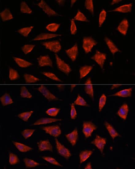 Immunocytochemistry/ Immunofluorescence: STAM2 Antibody [NBP3-38372] - Immunofluorescence analysis of L929 cells using STAM2 Rabbit pAb at dilution of 1:100. Secondary antibody: Cy3-conjugated Goat anti-Rabbit IgG (H+L) at 1:500 dilution. Blue: DAPI for nuclear staining.