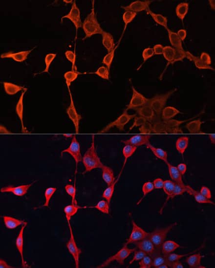 Immunocytochemistry/ Immunofluorescence: DNAJA2 Antibody [NBP3-38373] - Immunofluorescence analysis of NIH/3T3 cells using DNAJA2 Rabbit pAb at dilution of 1:100. Secondary antibody: Cy3-conjugated Goat anti-Rabbit IgG (H+L) at 1:500 dilution. Blue: DAPI for nuclear staining.