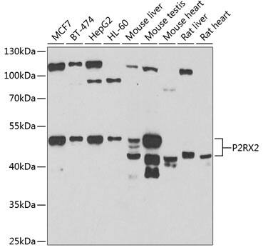 Western Blot: P2X2/P2RX2 Antibody [NBP3-38379] - Western blot analysis of various lysates using P2X2/P2RX2 Rabbit pAb at 1:1000 dilution.Secondary antibody: HRP-conjugated Goat anti-Rabbit IgG (H+L) at 1:10000 dilution.Lysates/proteins: 25ug per lane.Blocking buffer: 3% nonfat dry milk in TBST.Detection: ECL Basic Kit.Exposure time: 90s.