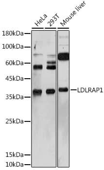 Western Blot: ARH Antibody [NBP3-38382] - Western blot analysis of various lysates using ARH Rabbit pAb at 1:1000 dilution.Secondary antibody: HRP-conjugated Goat anti-Rabbit IgG (H+L) at 1:10000 dilution.Lysates/proteins: 25ug per lane.Blocking buffer: 3% nonfat dry milk in TBST.Detection: ECL Basic Kit.Exposure time: 180s.